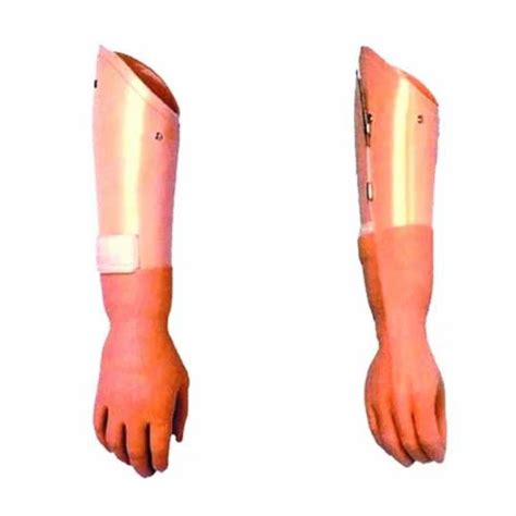 Upper Limb Prosthesis - Below Elbow Prosthesis Manufacturer from Bengaluru