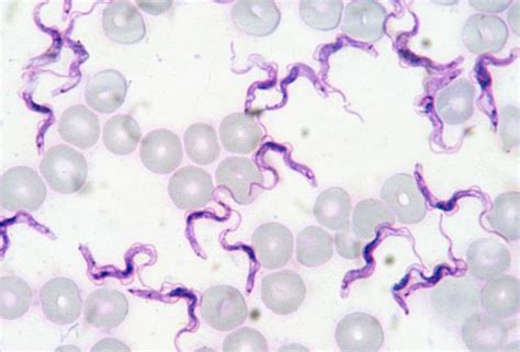 Difference Between Giemsa Stain and Wright Stain | Compare the Difference Between Similar Terms