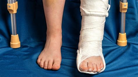 Midfoot and Forefoot Fractures (2018 Update)