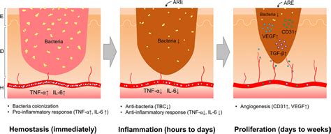 Possible mechanism of ARE in the inflammatory phase and proliferative... | Download Scientific ...