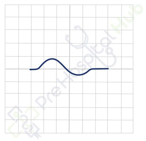 P Waves - Prehospital Hub