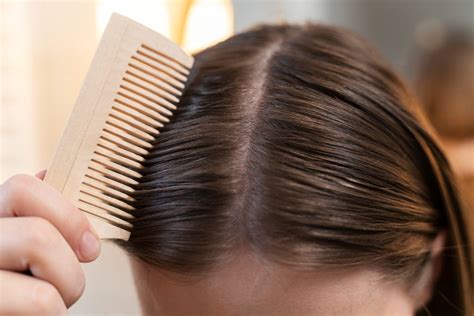 Burning Scalp Hair Loss: Symptoms, Causes, and Effective Treatments