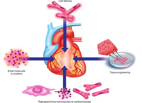 Approaches to cardiac regeneration after injury (clockwise from top):... | Download Scientific ...