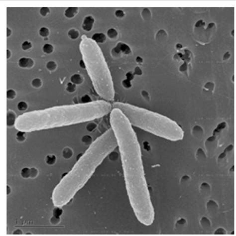 A scanning electron micrograph of P. stutzeri strain RCH2 in ...