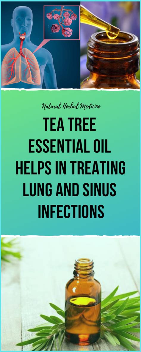 Tea Tree Essential Oil Helps in Treating Lung and Sinus Infections | Sinusitis, Sinus infection ...