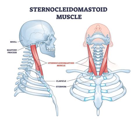 Sternocleidomastoid Trigger Points: Causes, Symptoms, and Treatment ...