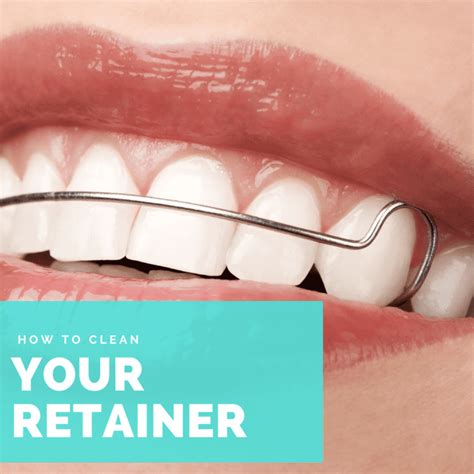 How to Clean Your Retainer