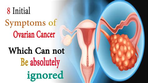 What Are Ovarian Cancer Symptoms? - Causes, Diagnosis, Treatment ...