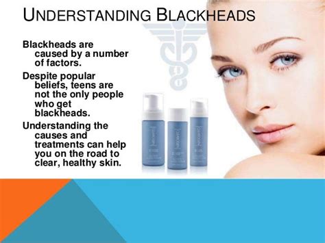 Common blackhead causes