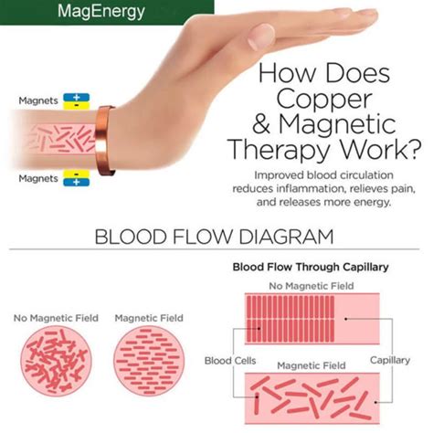 magnetic therapy - C Relief