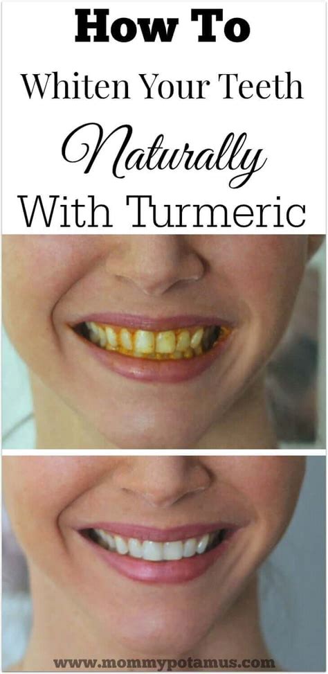 Turmeric Teeth Whitening At Home