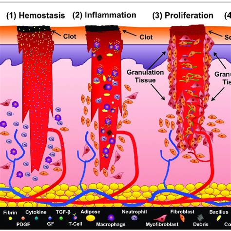 Surgical Wound Healing Stages