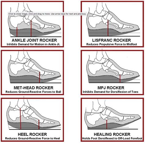 Rockered shoes...they're for MORE than hallux limitus... — The Gait Guys