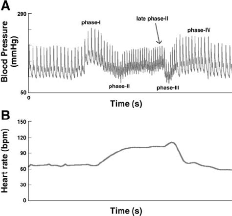 A representative Valsalva maneuver: arterial blood pressure (BP; A ...