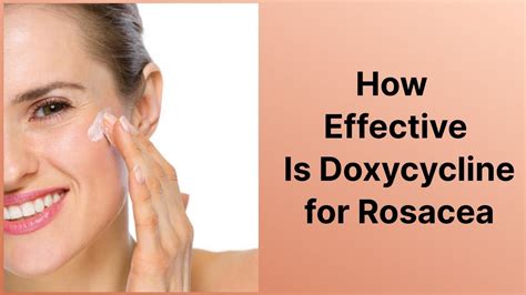 How Effective Is Doxycycline for Rosacea - YouTube