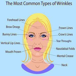 Common Types of Facial Wrinkles (Rhytides) - Westlake Dermatology