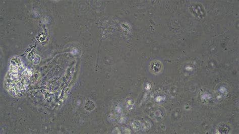 Saliva al microscopio - Saliva under the microscope - YouTube