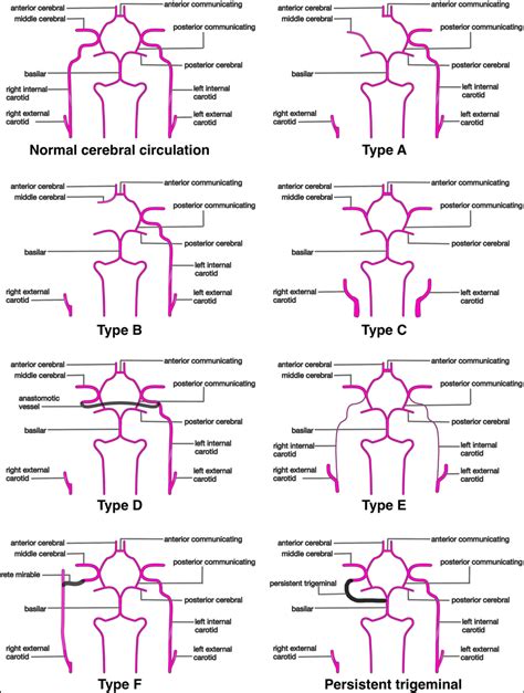 Arterial Anastomosis Pathways