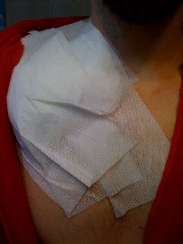 Port-a-cath dressing | iamcancerboy.blogspot.com | Cancer Boy | Flickr