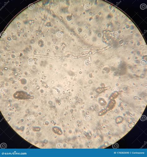 Alternaria Fungal Spores Under The Microscope Stock Image | CartoonDealer.com #178382749