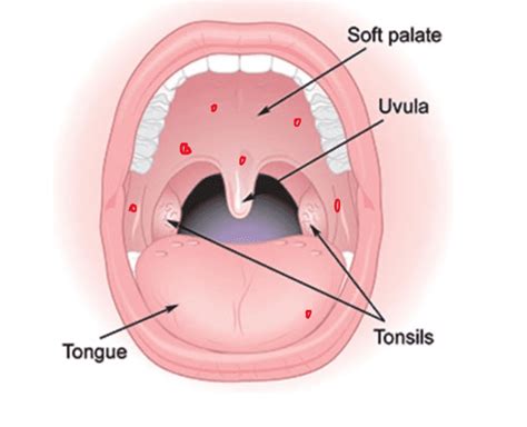 Causes of Throat Infections and Treatment