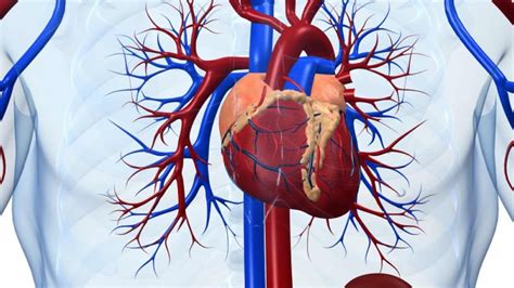 Cardiogenic Shock - Causes, Signs, Symptoms, Treatment