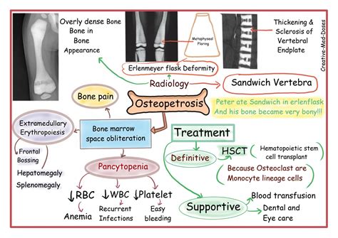 Osteopetrosis cartoons and illustrations - Creative Med Doses