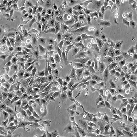 Green Fluorescent HeLa Cell Line – Cells Online