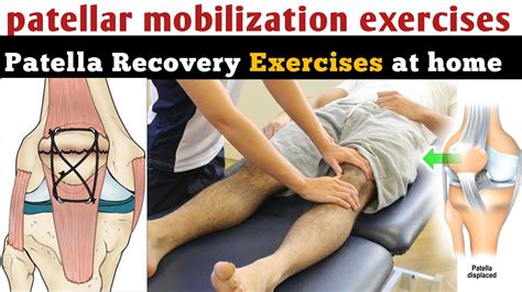 patellar mobilization exercises, patella fracture recovery time after surgery, knee bending ...