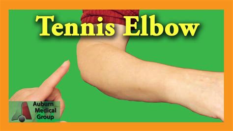 [DIAGRAM] Diagram Of Elbow Wart - MYDIAGRAM.ONLINE