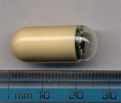 Capsule endoscopy - Wikipedia