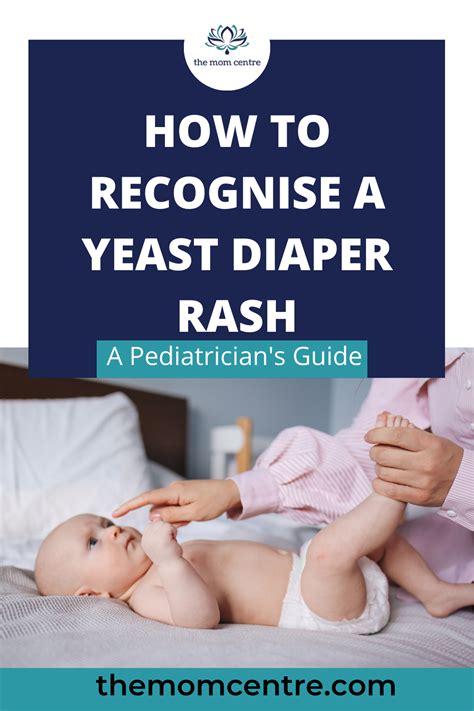 how to recognize and treat yeast diaper rash at home? - the mom centre