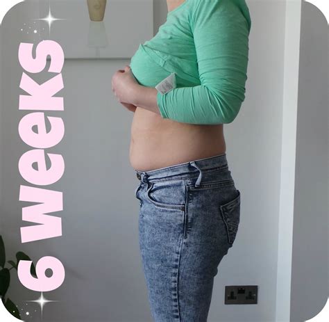 6 Week Pregnancy Update!! - how about now!?