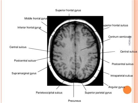 Centrum semiovale function