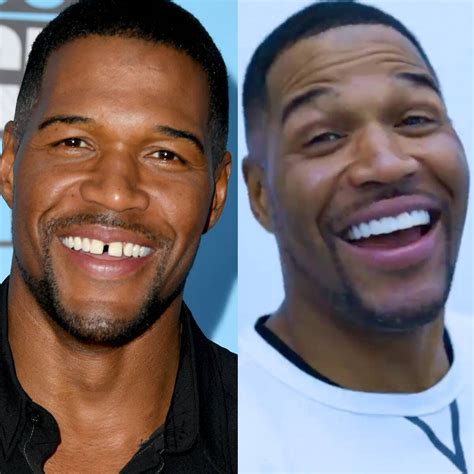 Michael Strahan Sets the Record Straight on Permanently Closing His Tooth Gap