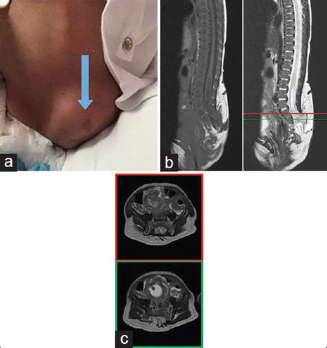 Surgical Neurology International