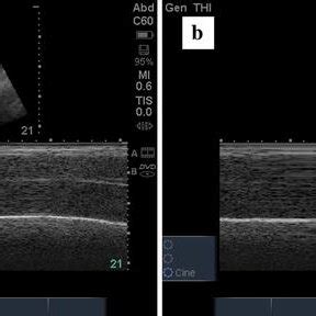 The subject’s diaphragm is shown moving over time with the arrow... | Download Scientific Diagram