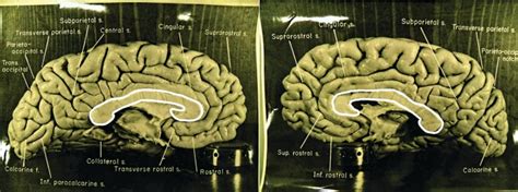 Inside Einstein’s Brain, Big Bang Props