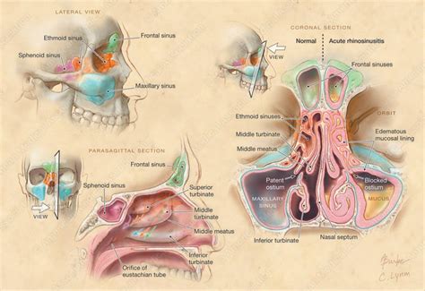 Medical and Scientific Illustration || Portfolio | Paranasal sinuses, Medical illustration ...