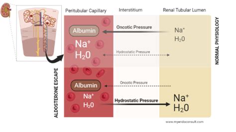 Aldosterone Escape Mechanism – My Endo Consult