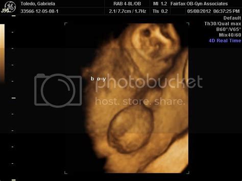 32 week 3d ultrasound pics | BabyCenter