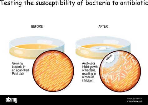 Antibiotic bacteria petri dish Stock Vector Images - Alamy