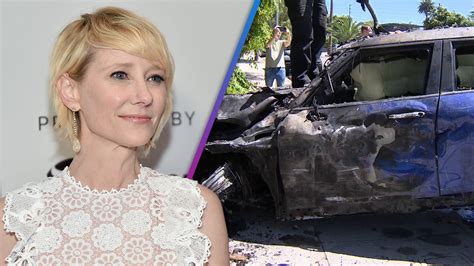 Anne Heche Car Crash: Burn Specialist Explains Her Injuries