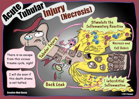 Acute Tubular Necrosis/Injury - Creative Med Doses