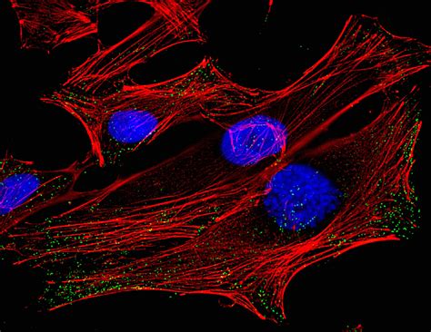 Sequencing Of HeLa Genome Revives Genetic Privacy Concerns | Health ...