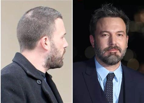 Ben Affleck Bald or Wearing a Toupee?