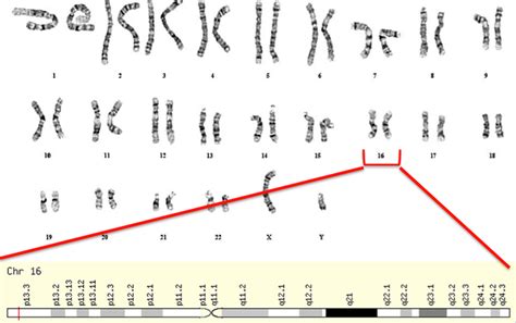 PKD1 Gene - Polycystic Kidney Disease and PKD1