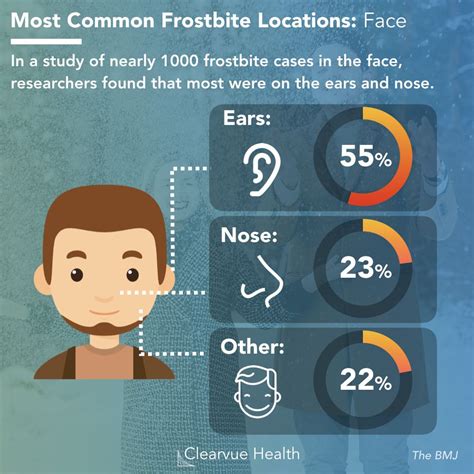 Chart of Frostbite locations on the face Cold Weather Camping, Winter Camping, First Aid Tips ...