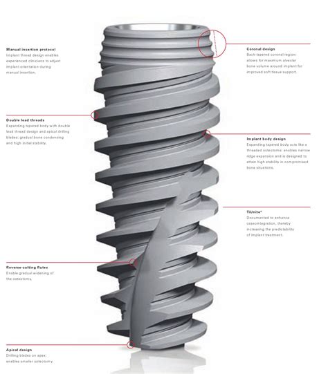 Nobel Biocare NobelActive Implant dentaire | SpotImplant