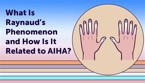 What Is Raynaud’s Phenomenon and How Is It Related to AIHA? | myAIHAteam